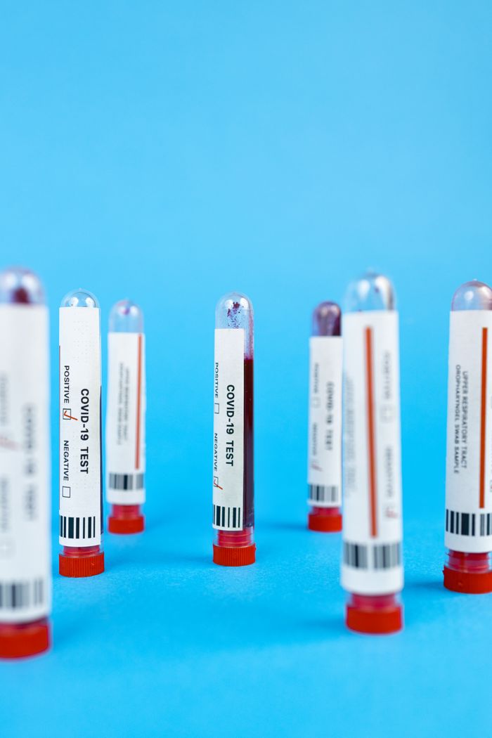 services-02 Close-up of COVID-19 blood test tubes on a blue background in a studio setup.